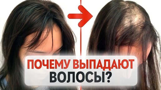 Почему у вас выпадают волосы? / Основные причины волосопада