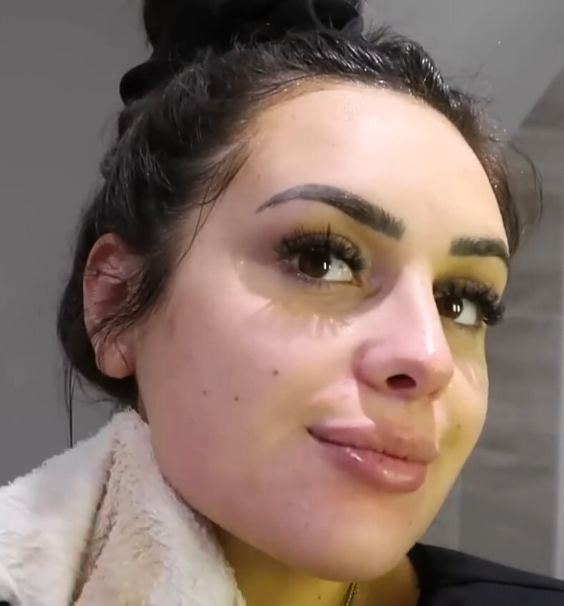 -2