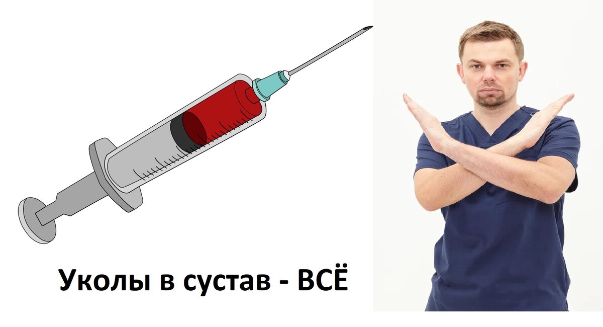 Внутрисуставные инъекции