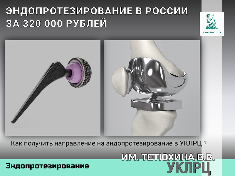 Эндопротезирование в России на мировом уровне за 320 000 рублей.