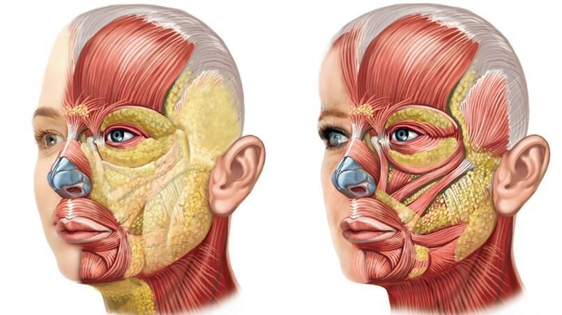 Количество жира на лице в 20 лет и 50 лет (возрастная атрофия)