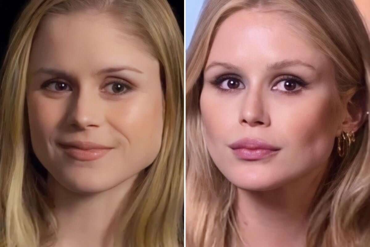 Erin moriarty face surgery