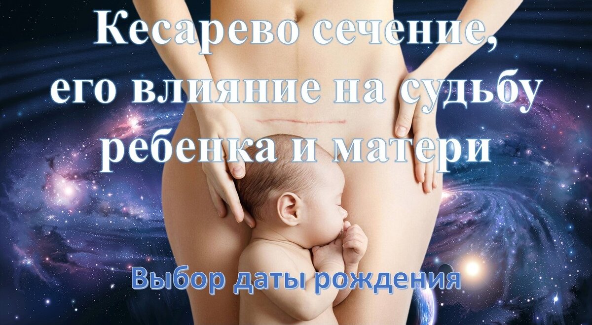 Кесарево сечение, его влияние на судьбу ребенка и матери. Выбор даты  рождения для ребенка. | Наталья - астрология наша жизнь | Дзен