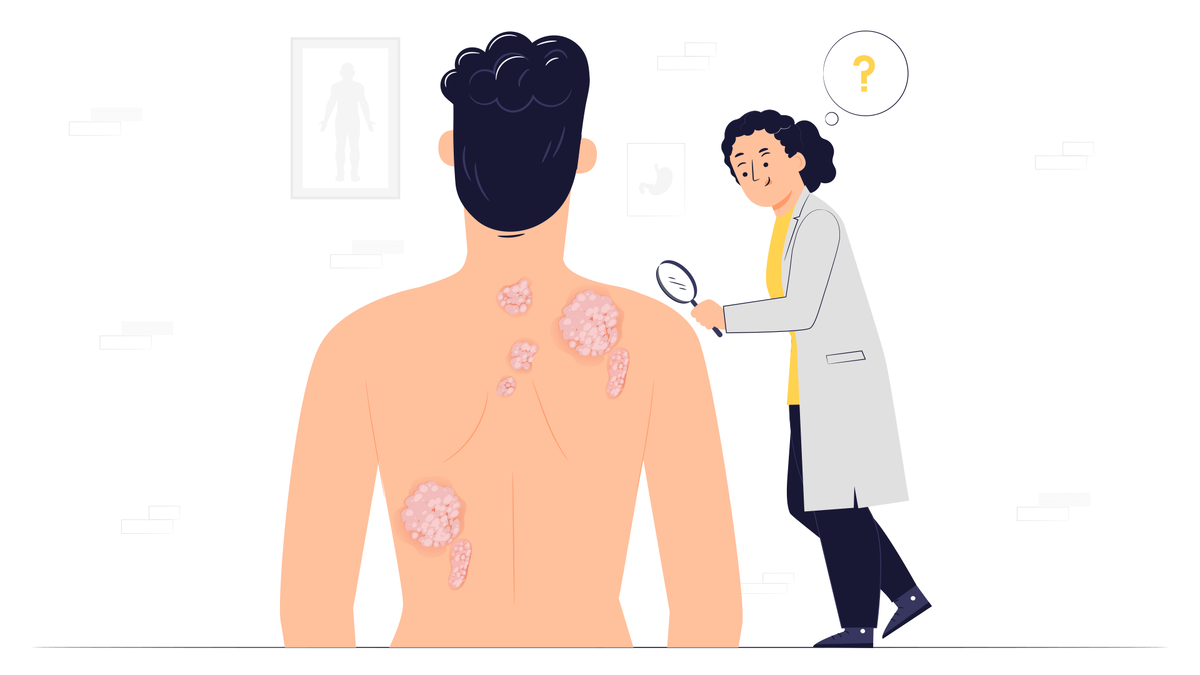 Берут ли в армию с псориазом? | ПризываНет | Дзен