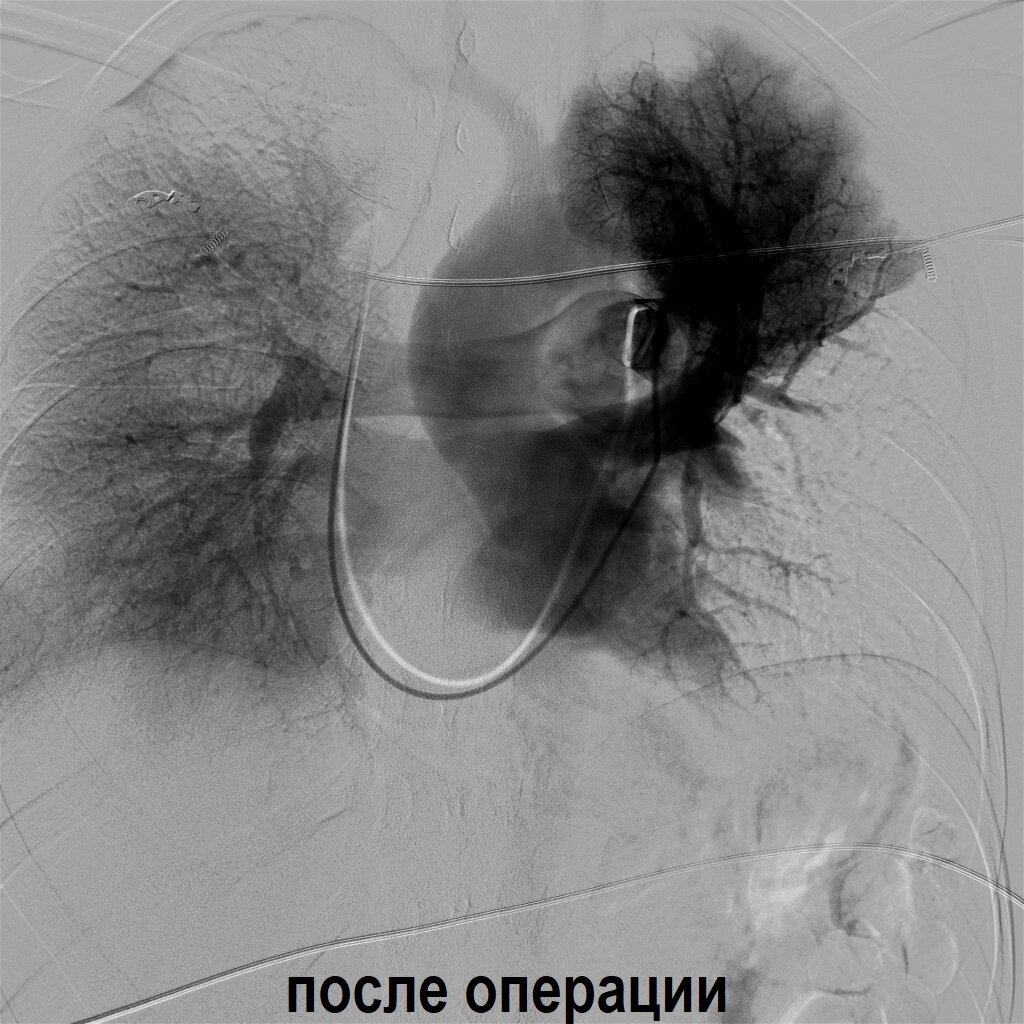Когда противопоказаны оральные контрацептивы? Какие побочные эффекты ...