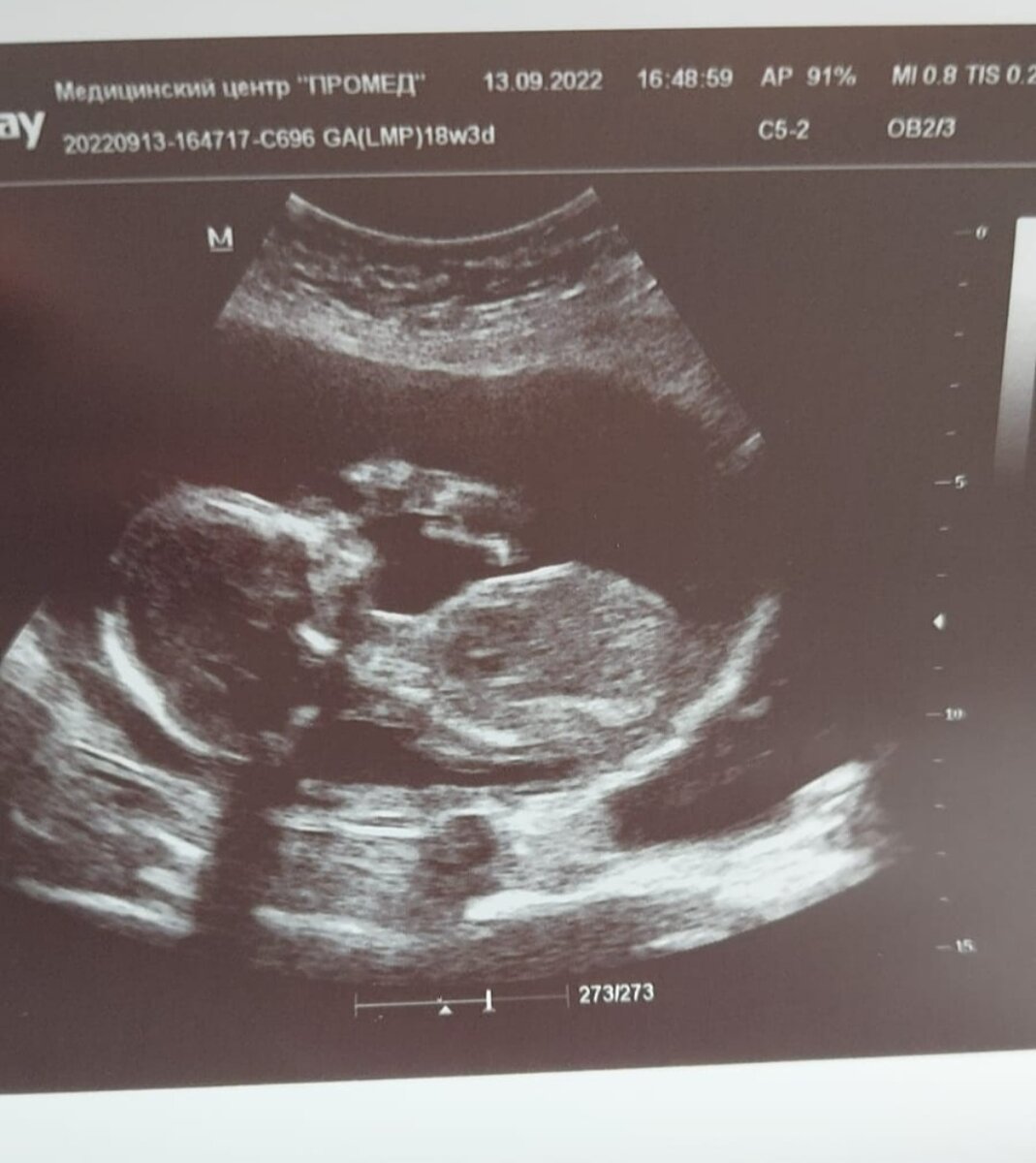 Фото моё.Наш Буратино.