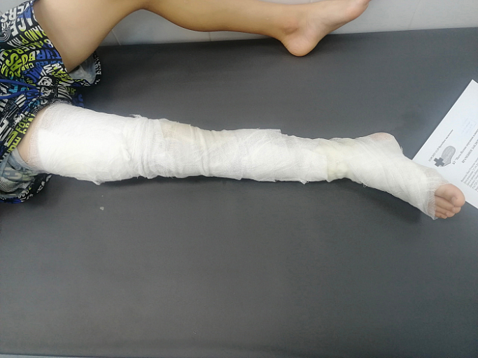    В Пыть-Яхе семье ребенка, провалившегося в яму с кипятком, выплатят 100 тысяч рублей