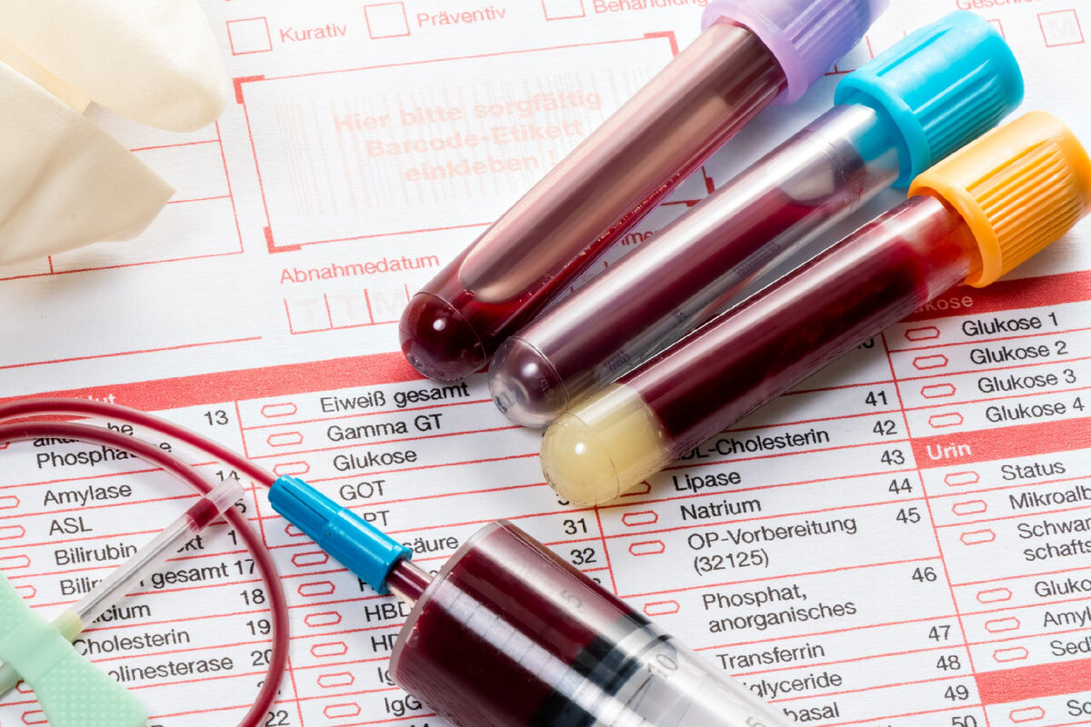 Взятие, условия хранения и доставки венозной крови для проведения ИФА и ПЦР