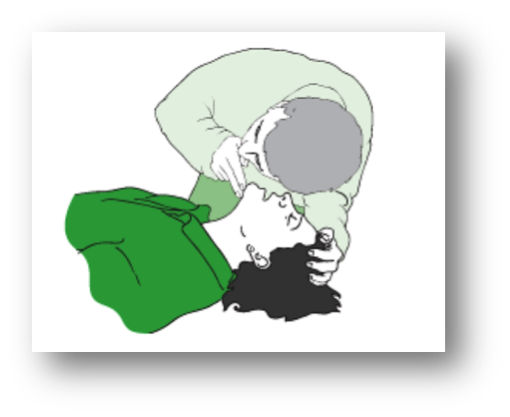 осторожно запрокиньте его голову: одну руку положите на лоб и осторожно отклоните голову назад, средним и указательным пальцем другой руки приподнимите пострадавшему подбородок, - это отодвинет язык от задней части горла: