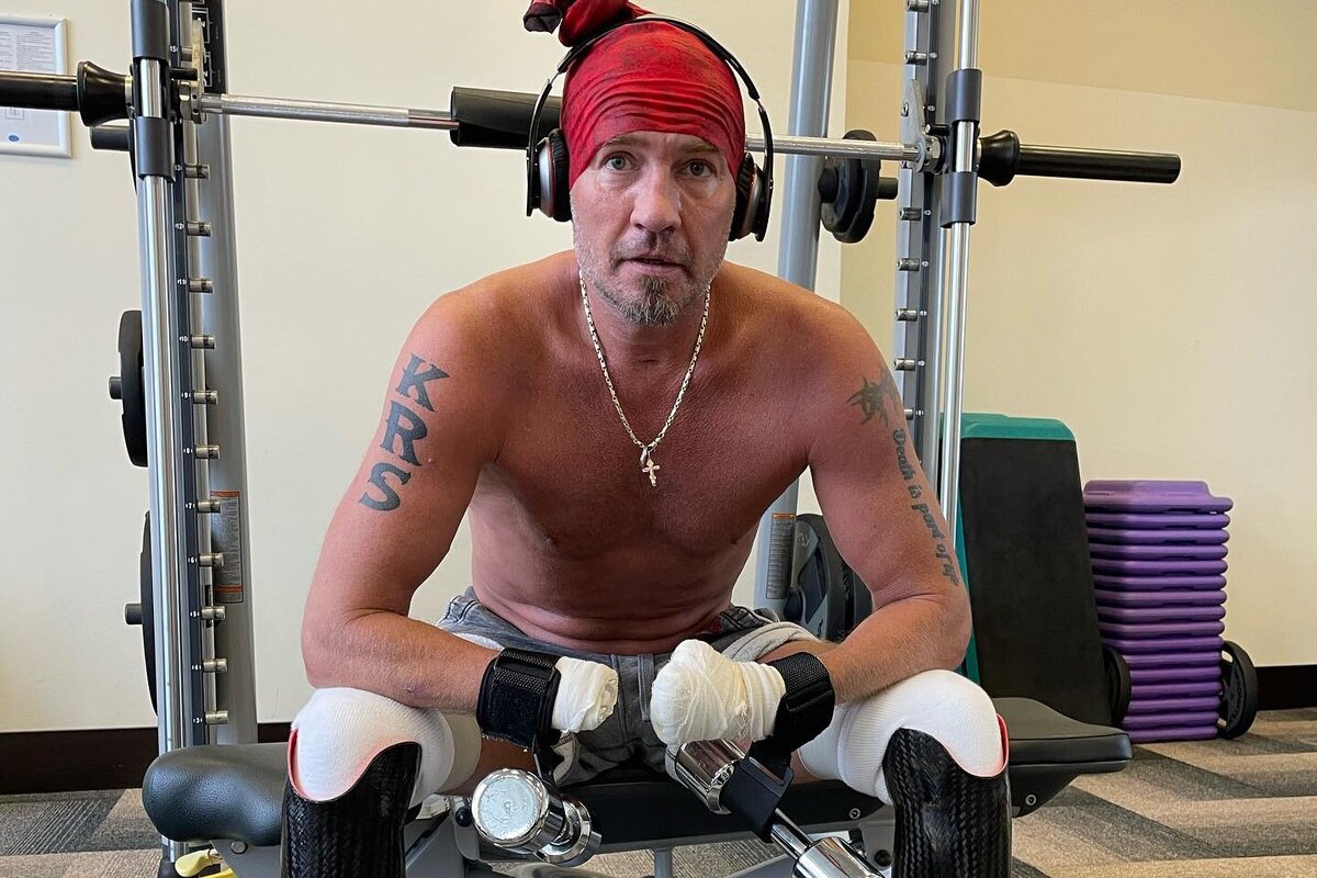 Можно заниматься спортом после удаления