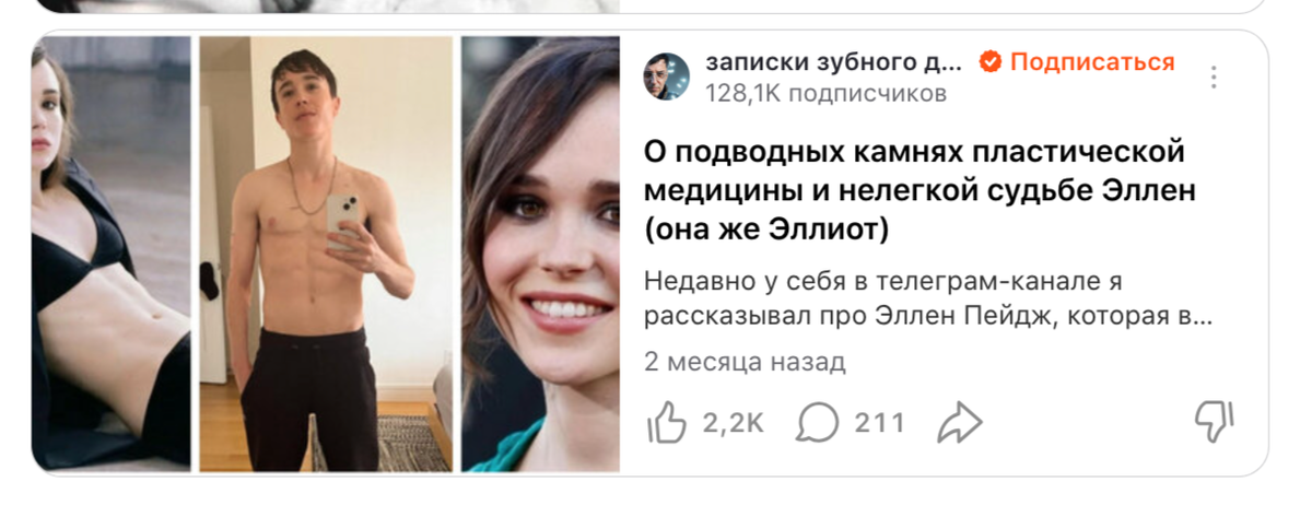 рекомендации Дзена под статьей