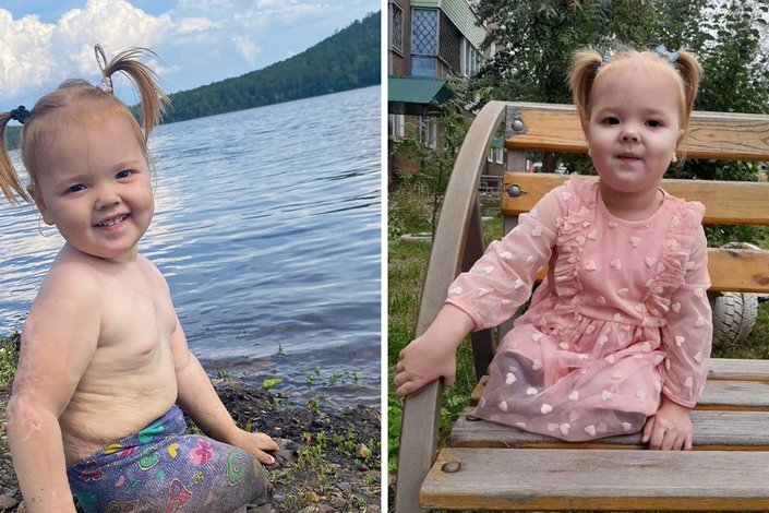 12см стопа у ребенка какой размер обуви. Нога девочки 1 год. Нога девочки 1 год. Размер обуви у детей таблица по см и возрасту. Нога девочки 1 год.