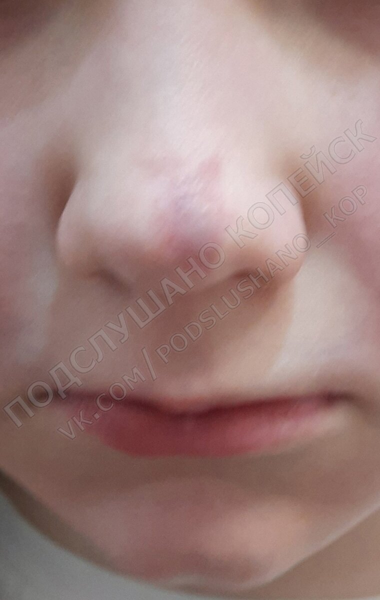 Nose are перевод