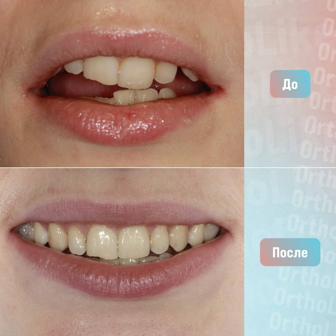 герасимова яна олеговна ортодонт. врач ортодонт. стоматолог ортодонт. врач ортодонт детский отзывы. ортодонтия.