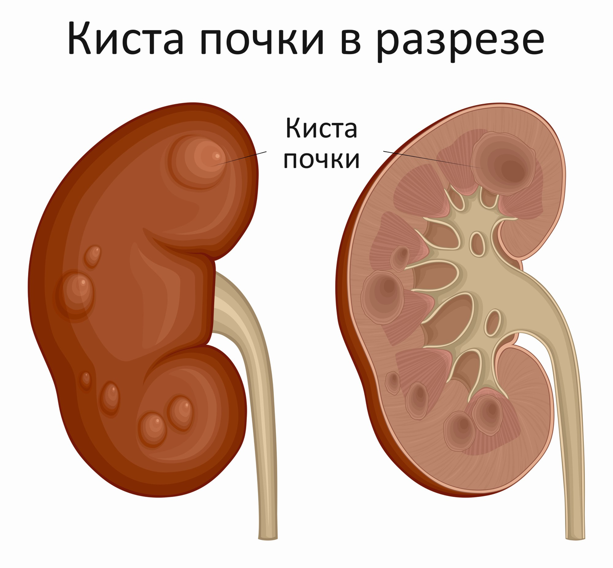 Выяснить ли