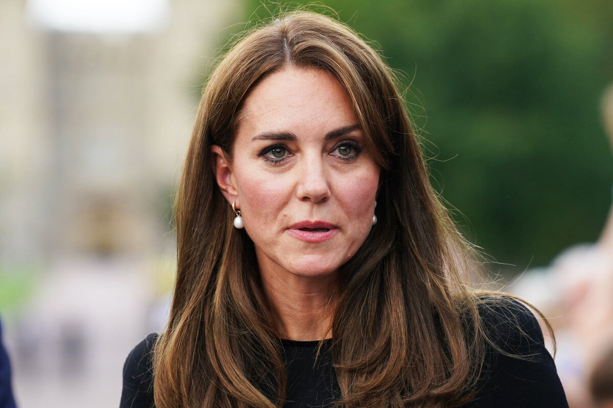     Шрам на голове, сильнейшая тошнота и операции: подробности состояния здоровья Кейт Миддлтон