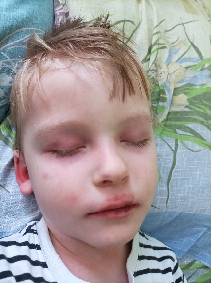 Глаза, губы