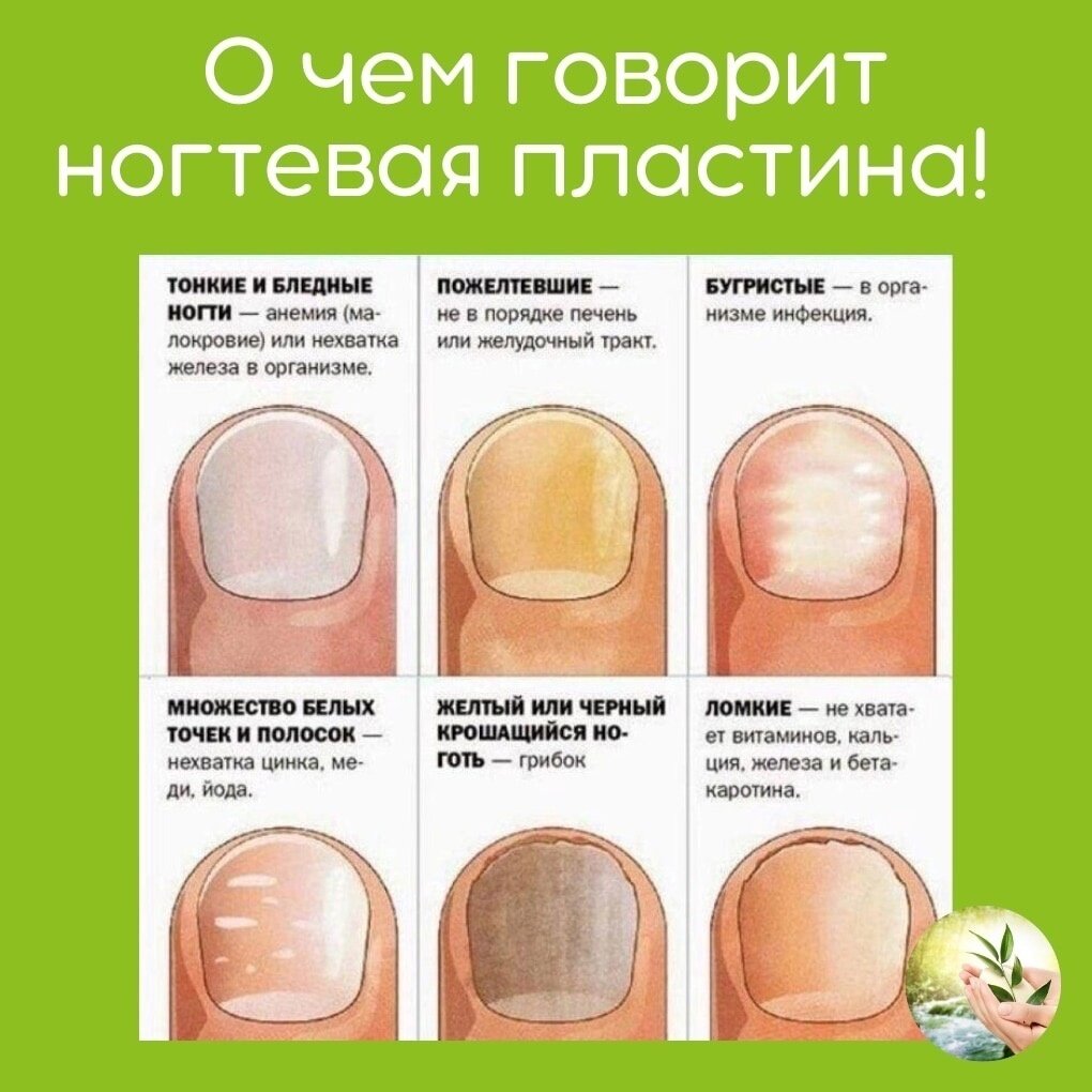 По фото определить заболевание ногтей