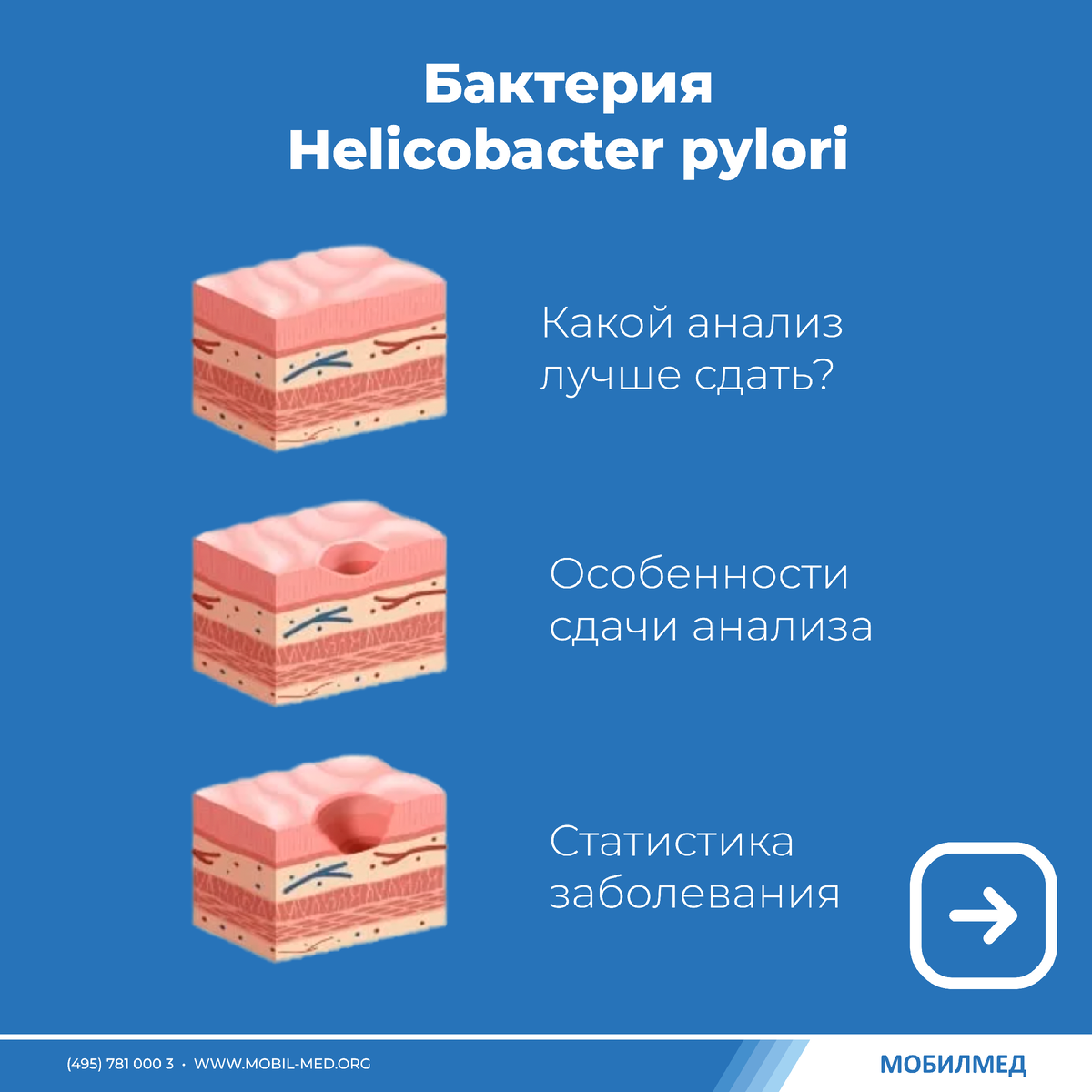 Устранить причину гастрита: Helicobacter pylori | МобилМед - твоя ...