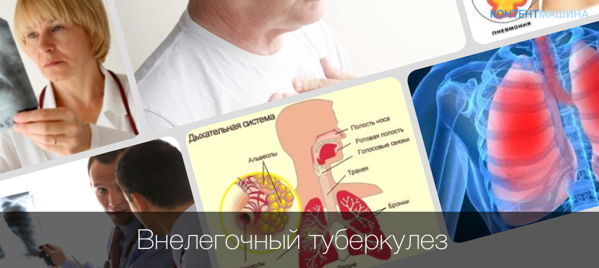 Туберкулез спорт