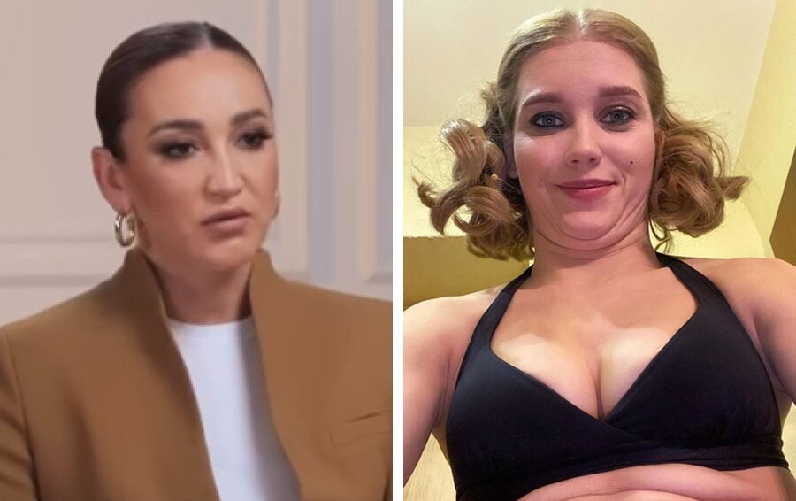    Лицо испортилось раньше времени