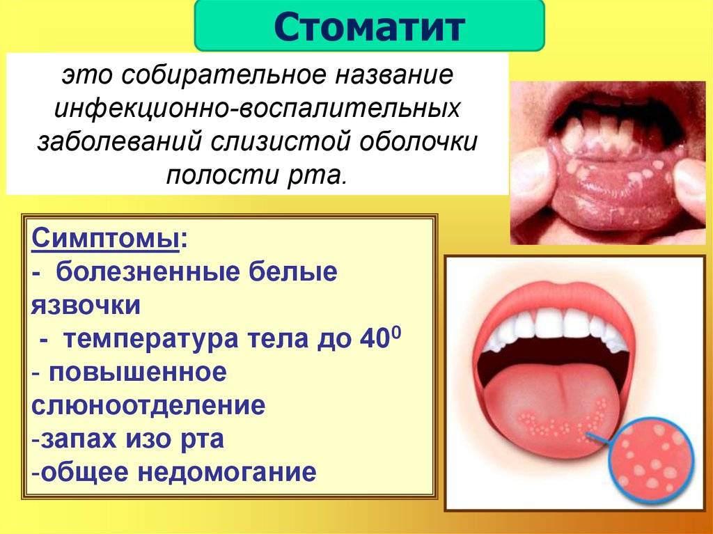 После стоматолога губе - найдено 81 картинок