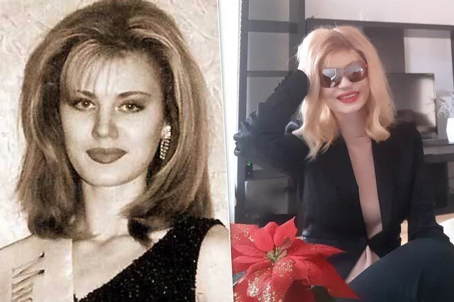 Элеонора кондратюк до и после операции 25 лет назад ей плеснули в лицо кислотой. Но она выжила, обрела любовь и семью. 