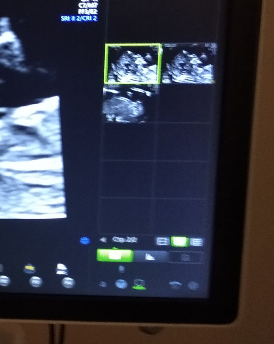 Хгч показатели нормы таблица. Норма показателя хгч по неделям беременности. Развитие эмбриона по неделям. 2 недели беременности размер. Беременность 1-2 недели от зачатия эмбрион.