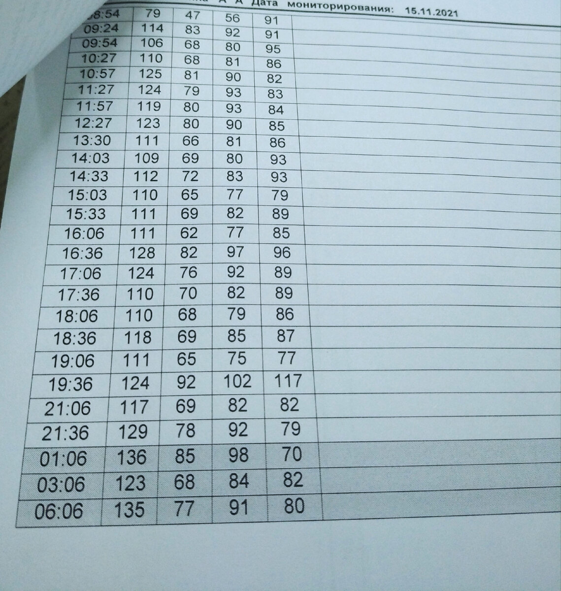 Показатели мониторинга давления, снятые за сутки.