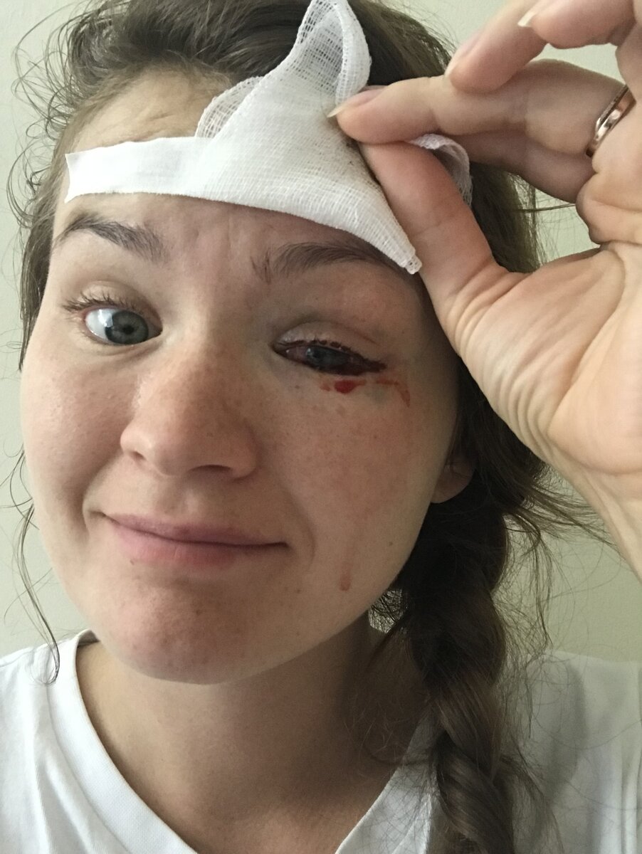 Где-то после первых операций 