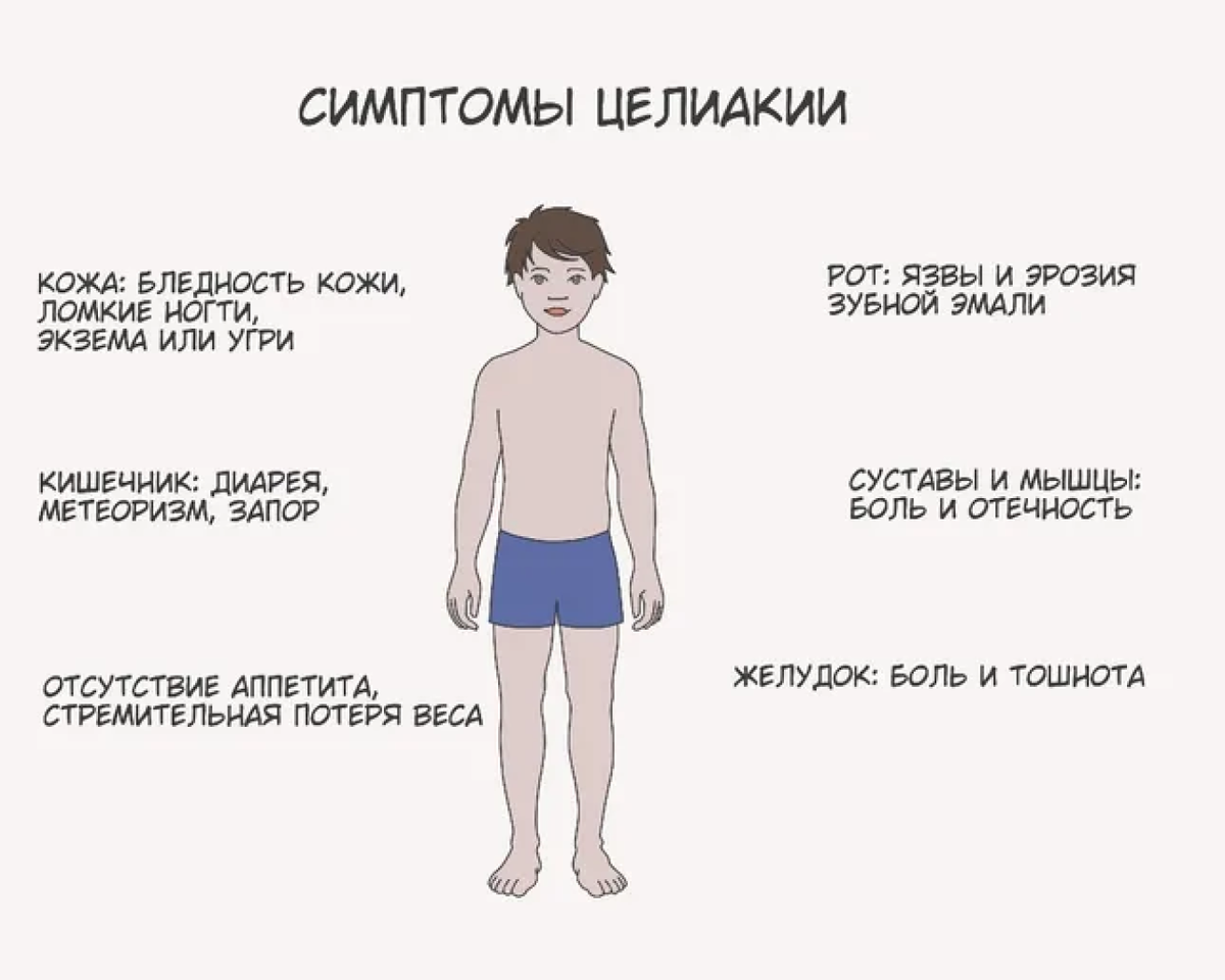 Можно ли при целиакии. Симптомы целиакии у детей до года. клиническим признакам целиакии. целиакия наследственное заболевание.