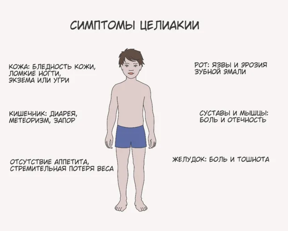 Симптомы целиакии у детей до года. Клиническим признакам целиакии. Целиакия наследственное заболевание.