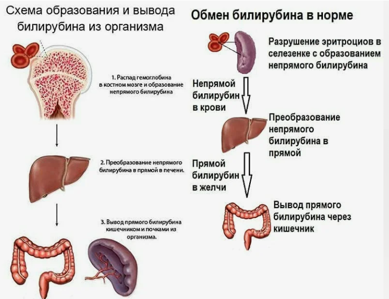 Нарушение билирубинового обмена