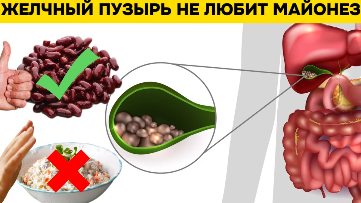 Какие продукты любит желчный