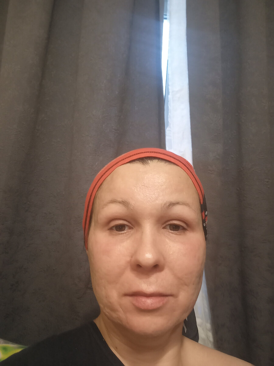 Нечего особенного. Сходила к аллергологу | Вечно худеющая мама в зажоре ...