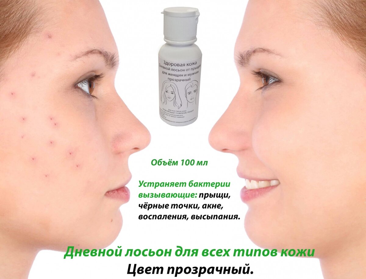 Взято из открытых источников