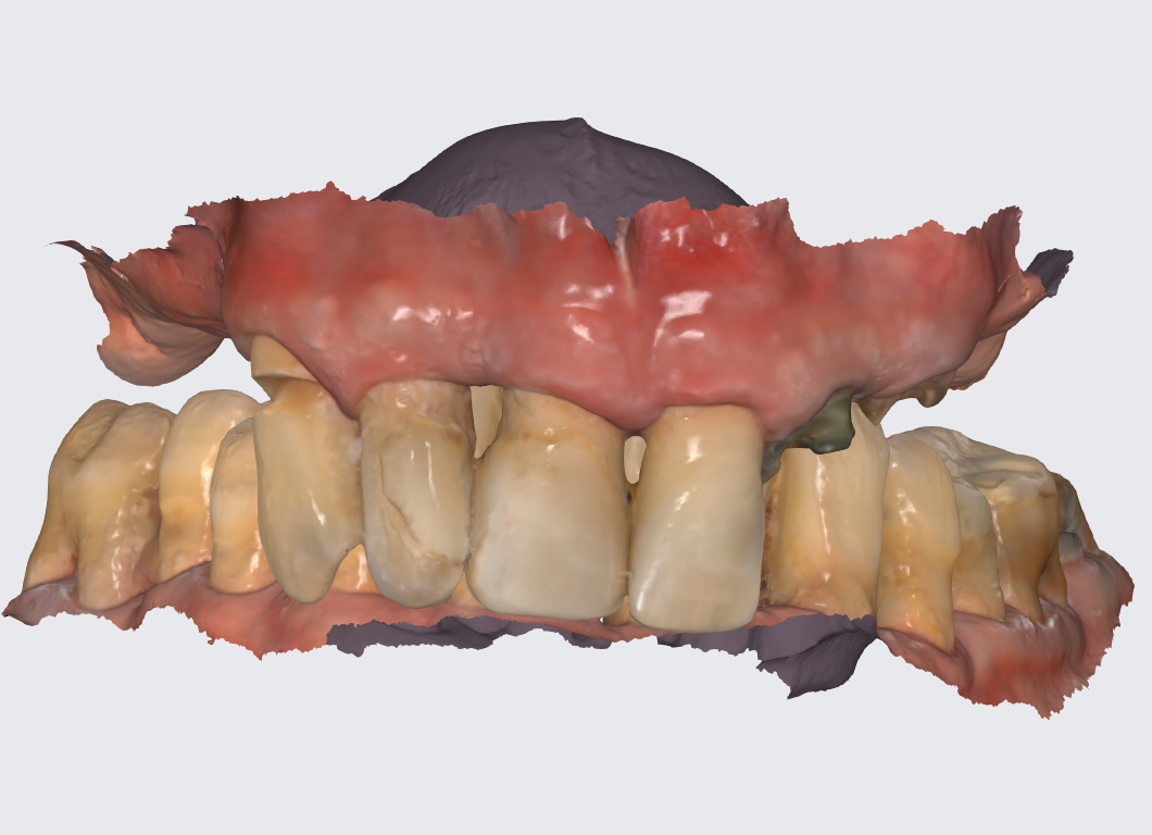 "Всё на 4-х", подготовка. Цифровой слепок
