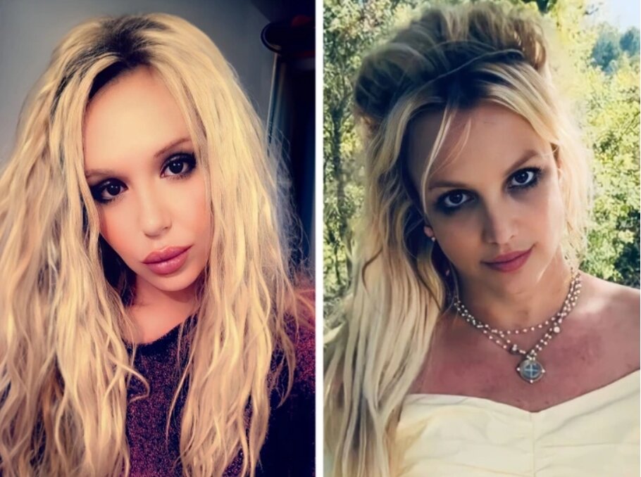 жд пластическая хирургия. наумов владимир викторович. жд пластическая хирургия. блефаропластика екб. пластическая хирургия картинки.