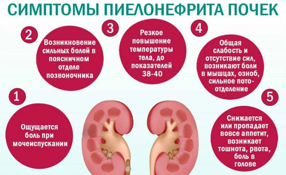 Боль и ноет в почках. Пиелонефрит симптомы у женщин. Симптомы при пиелонефрите. Пиелонефрит почек симптомы.