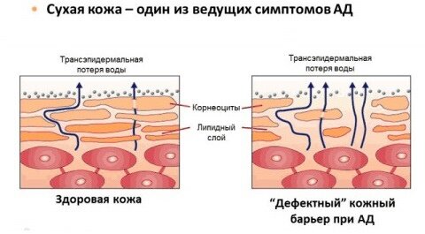 Фото из сети "Интернет" 