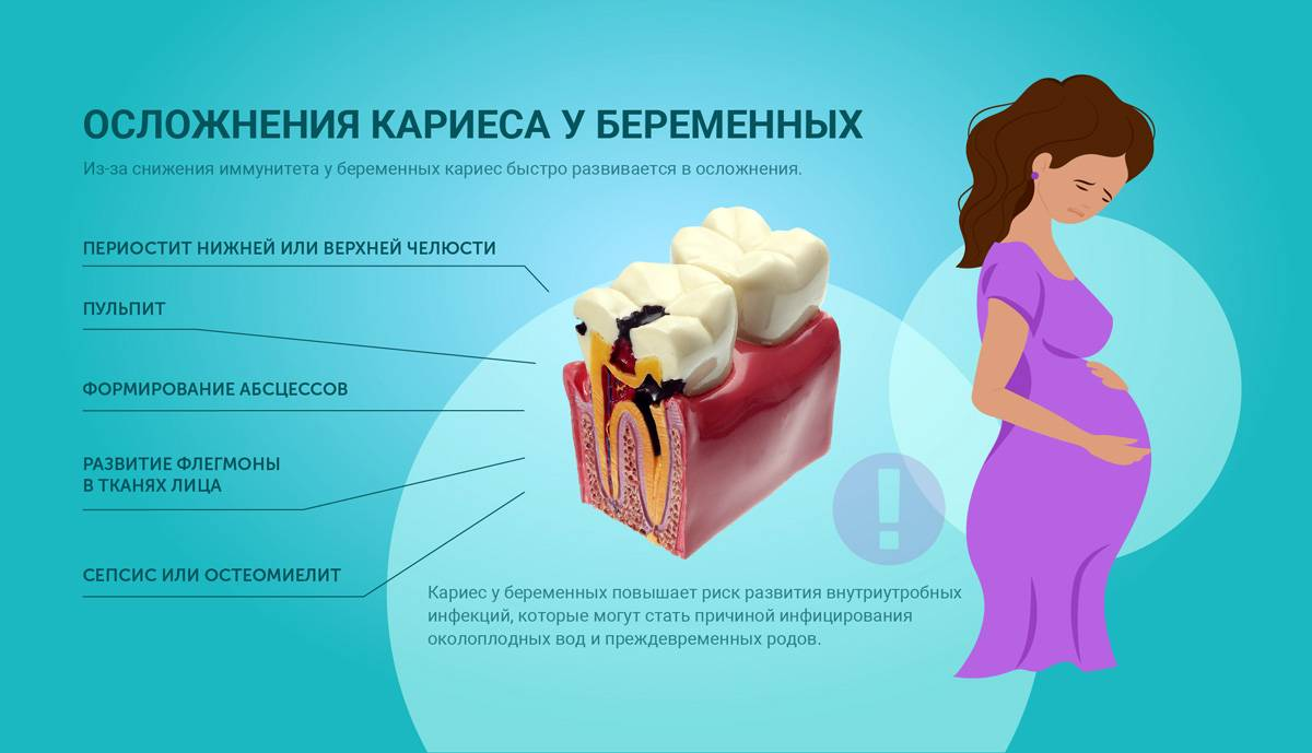 Боли на 21 неделе беременности. Профилактика кариеса у беременных. Кариес зубов при беременности. Профилактика кариеса зубов у беременных.