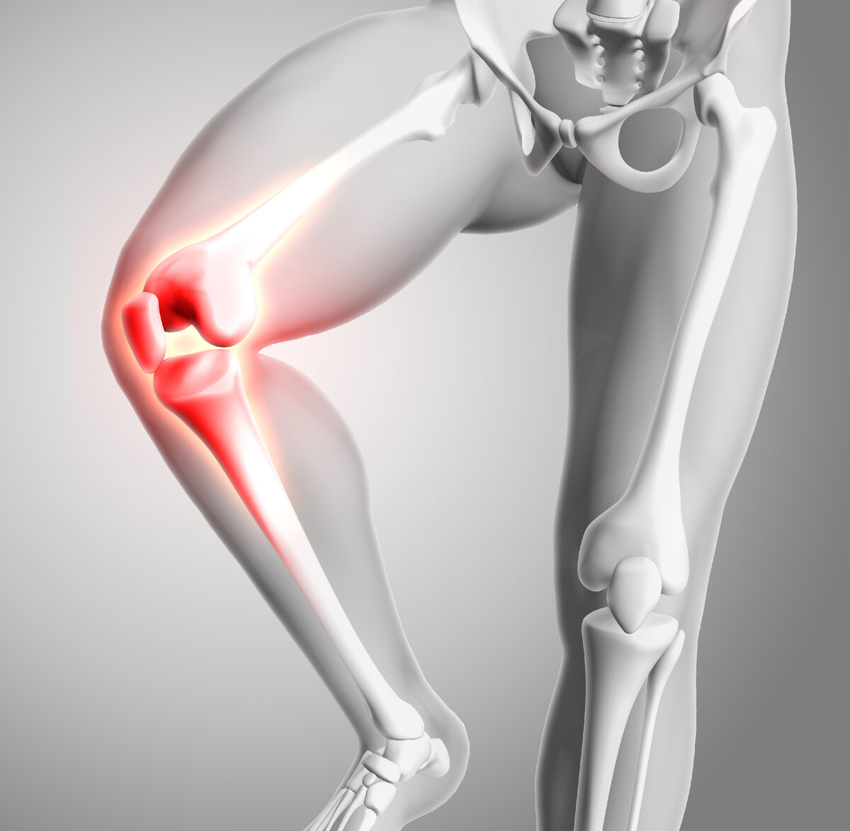 <a href="https://ru.freepik.com/free-photo/3d-render-of-a-medical-figure-with-close-up-of-knee-and-glowing-bones_9510521.htm#query=%D0%B0%D1%80%D1%82%D1%80%D0%BE%D0%B7&position=14&from_view=search&track=sph&uuid=5631a112-8815-4040-87a4-0f13d0f4fa93">Изображение от kjpargeter</a> на Freepik