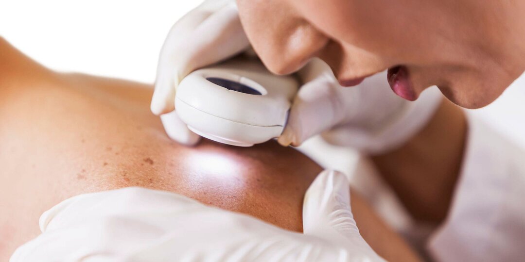 Красные точки на теле: их происхождение, профилактика и лечение. Опасны ли они для нашего здоровья?