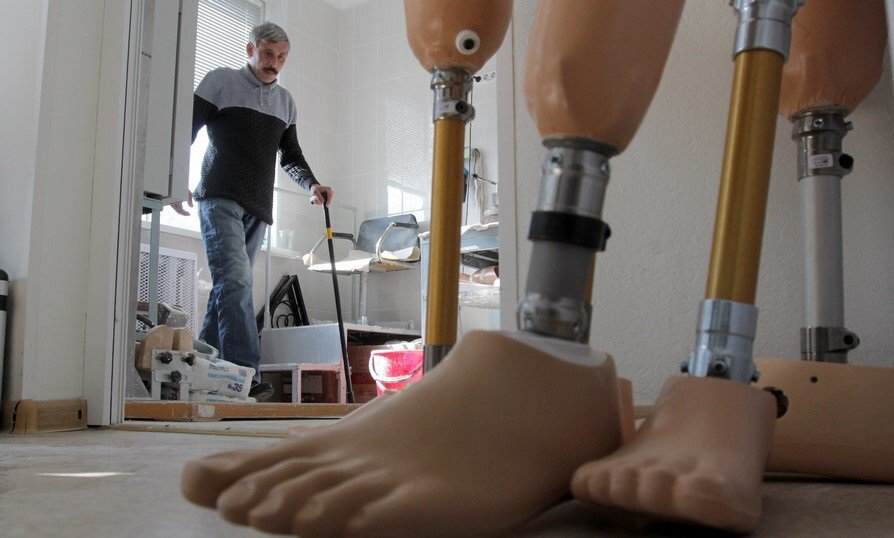 Донецкий Республиканский протезно-ортопедический центр. Современные протезы ног. Протезист конечностей