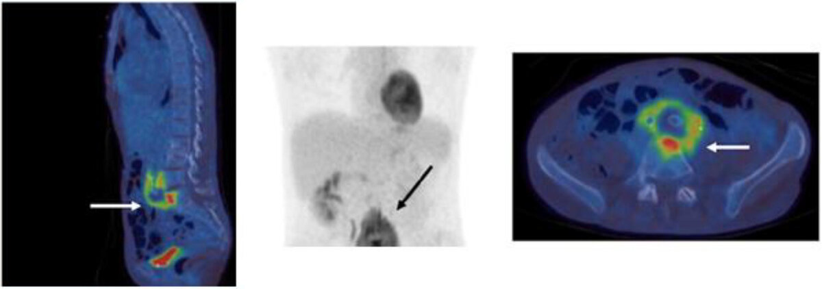   Lara Payne et al. / Clinical Infection in Practice, 2024