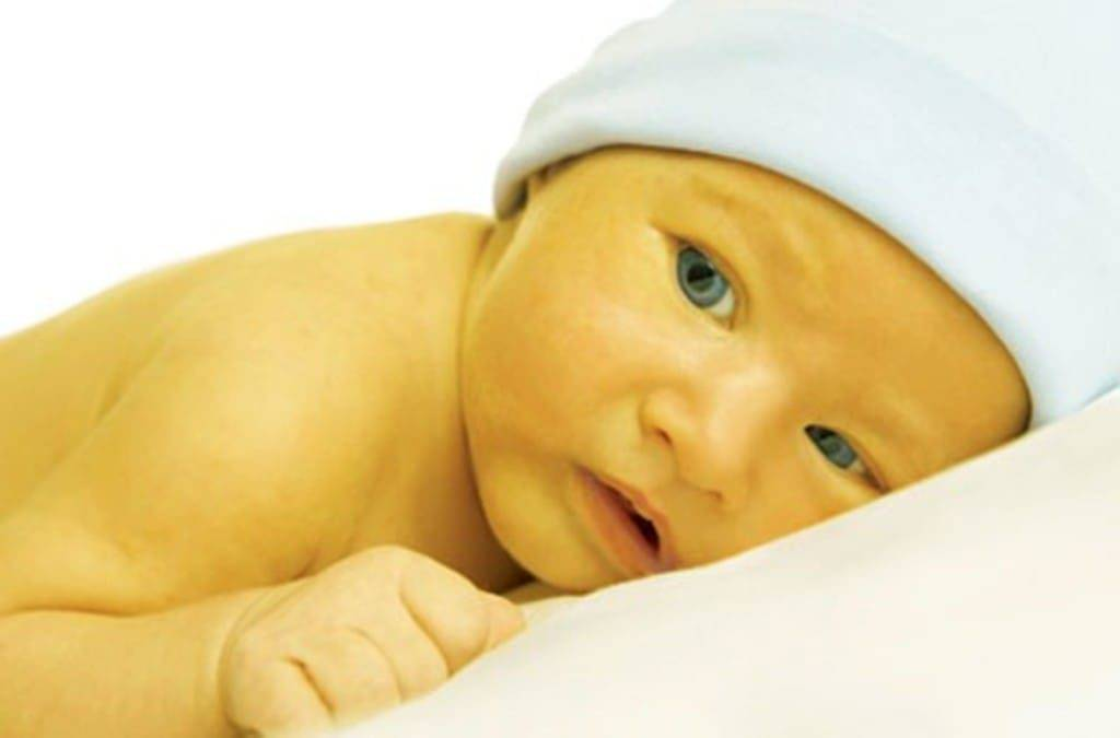 Ребенок желтуха почему. Что такое желтушка у новорожденных детей. Транзиторная желтуха новорожденных. Неонатальная желтушка у новорожденного.