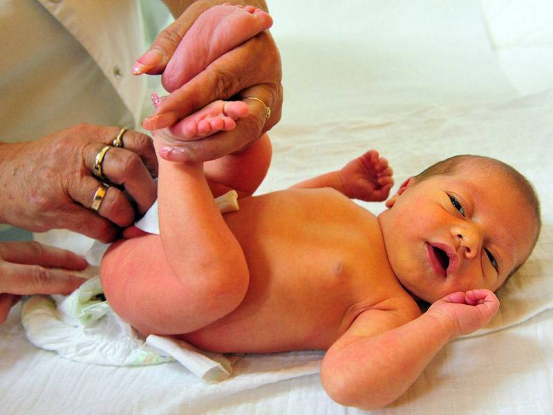 Почему младенцы красные. Неонатальная желтуха физиологическая. Желтушка у новорожденных. Желтуха у детей новорожденных. Желтушность у новорожденных.