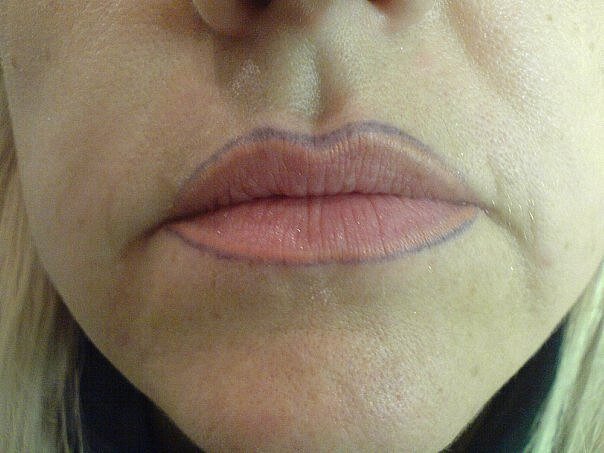 Неудачный перманентный макияж губ. Неудачный перманент губ. Ужасный перманентный макияж губ. Губы выходят за контур