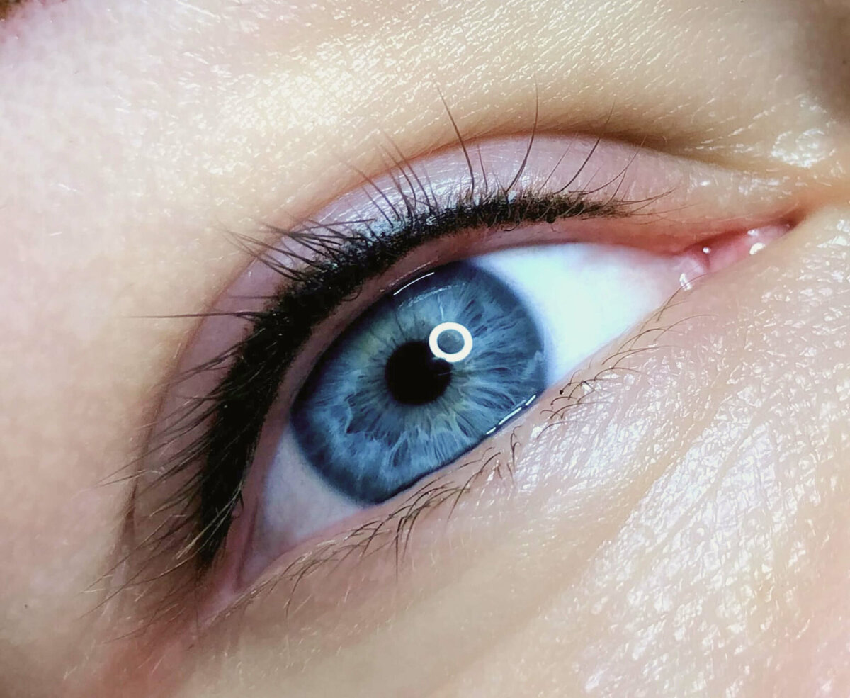 Межресничка