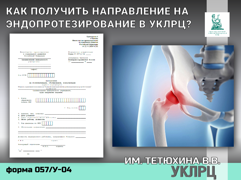 КАК ПОЛУЧИТЬ НАПРАВЛЕНИЕ НА ЭНДОПРОТЕЗИРОВАНИЕ В УКЛРЦ
